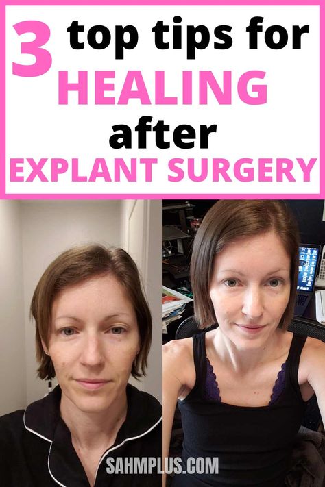 3 recovery tips after explant surgery. Natural healing after surgery Breast Explant Before And After, Healing After Surgery, Explant Surgery, Detox Shakes, Breast Implant Illness, Back To The Gym, Tea Health Benefits, Push Yourself, Breast Surgery