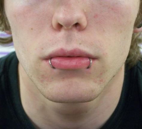 Spiderbite Piercings, Snake Bite Piercing, Mouth Piercings, Men's Piercings, Snake Bite, Snakebites, Face Piercings, Cool Piercings, Snake Bites