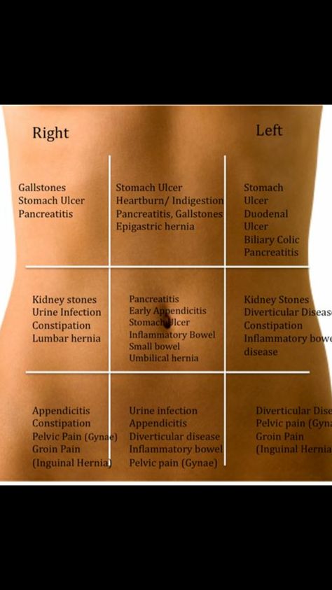 Abdominal Pain Chart, Pain Chart, Med School Study, Medical School Life, Basic Anatomy And Physiology, Nurse Study Notes, Nursing Student Tips, Biology Facts, Medical Student Study