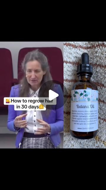 How To Use Batana Oil For Hair Growth, Best Hair Vitamins For Hair Growth, Batana Oil Hair Growth, Batana Oil Before And After, Batana Oil Benefits, Hairline Growth, Party Ponytail, Dry Flaky Scalp, Best Hair Growth Oil