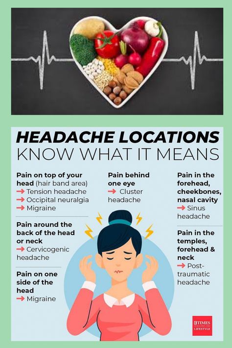 #HealthFitnessTips Different Types Of Headaches And What They Mean, Types Of Headaches Chart, Headache Location Meaning, Forehead Headache, Headache Location, Headache Chart, Gym Moves, Sinus Migraine, Remedy For Sinus Congestion