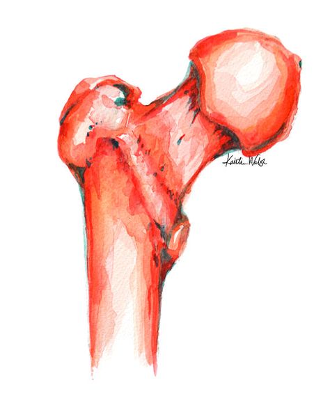 Femur Watercolor Print - Orthopedic Surgery Art - Medical Art - Anatomy Art Medicine Painting Art, Surgery Art, Watercolor Anatomy, Medical Related Paintings, Medical Abstract Art, Orthopedic Painting, Watercolor Medical Art, Medical Office Decor, Male Figure Drawing