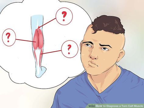 3 Ways to Diagnose a Torn Calf Muscle - wikiHow Torn Calf Muscle Rehab, Torn Calf Muscle, Achilles Tendon Ruptures, Calf Strain, Calf Pain, Ligament Tear, Calf Muscles, Sports Injury, Sports