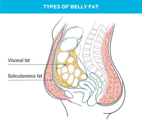 How To Lose Belly Fat, According to Science | Precision Nutrition How To Get Rid Of A Pot Belly, Losing Visceral Fat, Hormonal Belly, Cut Belly Fat, Sanne Vloet, Get Back In Shape, Belly Fat Reduction, Loose Belly, Precision Nutrition