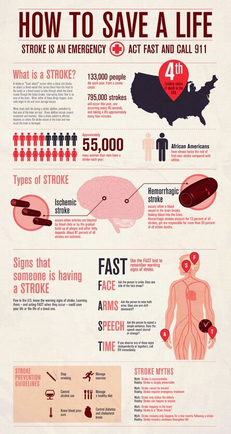 Infographic for American Stroke Prevention Scientific Poster Design, Info Poster, Types Of Strokes, Scientific Poster, Research Poster, Graphic Design Infographic, Infographic Poster, Medical Knowledge, One Month