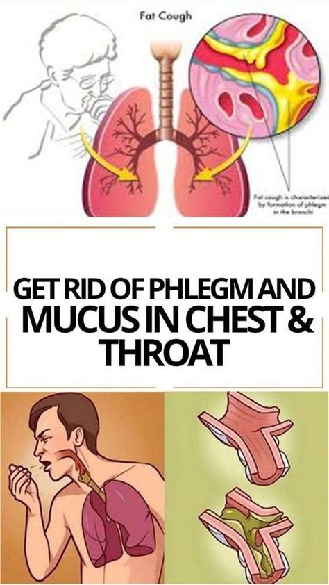 Mucus accumulations make you feel as if there’s something stuck in your throat. You sense an urge to clear your throat, and it’s really frustrating. This problem is usually created by infections in the upper respiratory tract, but mucus accumulations may be triggered by allergies, asthma, and he... Mucus In Chest, Mucus In Throat, Getting Rid Of Mucus, Chest Congestion Remedies, Mucus Relief, Getting Rid Of Phlegm, Home Remedies For Bronchitis, Sinus Congestion Relief, Toddler Cough Remedies