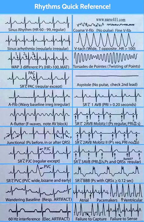 MedicTests.com on Twitter: "https://t.co/Mp5VgxDSog" / Twitter Emt Paramedic Aesthetic, Paramedic Aesthetic, Nurse Knowledge, Paramedic Study, Ekg Rhythms, Cardiac Rehab, Emt Study, Er Tech, Psychotropic Medications