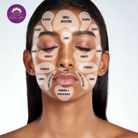 Face Pimple Chart, Face Breakout Chart, Face Acne Chart, Acne Mapping Face, Acne Placement Meaning, Acne On Cheeks, Acne Map, Acne Chart, Acne Face Map