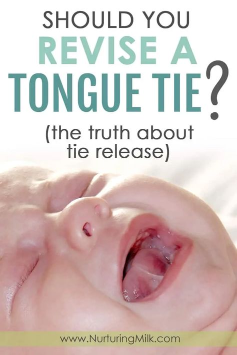 Tongue Tied Baby, Upper Lip Tie, Newborn Breastfeeding Tips, Myofunctional Therapy, Reflux Baby, Low Milk Supply, Natural Face Cleanser, Pediatric Dentist, Tongue Tie