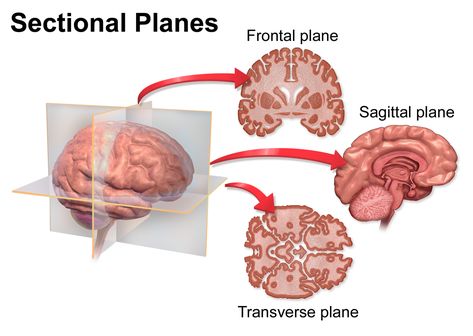 From Wikiwand: Coronal plane Sunburst Wallpaper, Frontal Plane, Ovulation Pain, Sagittal Plane, Thoracic Cavity, Human Body Structure, Sigmoid Colon, Referred Pain, Organ System