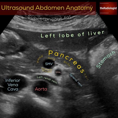 Read on to learn more about ultrasound!⁣ ⁣ ULTRASOUND ABDOMEN⁣ 👨🏽‍💻With the increasing use of CT and MRI I know some radiologists who turn… Diagnostic Medical Sonography Student, Ultrasound School, Ultrasound Physics, Obstetric Ultrasound, Nursing School Life, Sonography Student, Vascular Ultrasound, Ultrasound Sonography, Radiology Student