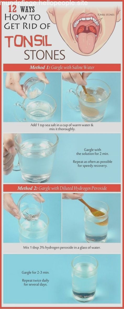 Saline Water, Healthy Ideas, Homemade Remedies, Natural Home Remedies, Happy Healthy, Natural Home, Oral Hygiene, Health Remedies, Natural Healing