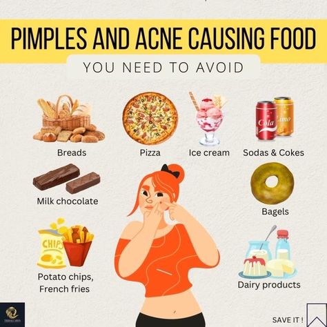 Things To Eat To Get Rid Of Acne, What Foods Cause Acne, Foods To Eat To Help With Acne, Foods To Get Rid Of Acne, What Your Pimples Mean, What To Eat To Get Rid Of Acne, Foods To Eat To Get Rid Of Acne, Acne Safe Foods, Foods That Cause Acne