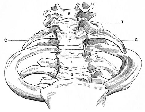 Thoracic Outlet, Physiotherapy Exercises, Subclavian Artery, First Rib, Vascular Surgery, Cervical Vertebrae, Muscle Atrophy, Scar Tissue, Anatomy And Physiology