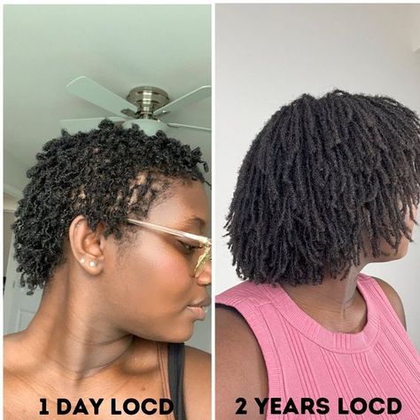 Sister Locs On Short 4c Hair, Microlocs 1 Year, Sister Locks Vs Micro Locks, Sisterlocs Vs Micro Locs, Microlocs Short Hair, Low Density Microlocs, Micro Locs Short Hair, Microlocs On Short Hair, Thick Micro Locs