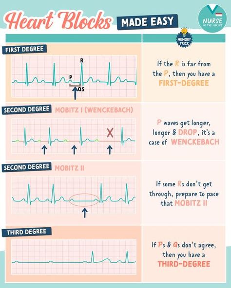 Nursing Cardiac, Cardiac Surgery Nursing, Ekg Interpretation Made Easy, Pharmacology Studying, Nurse Skills, Nursing School Inspiration, Family Nurse Practitioner, Med School Motivation, Medical Surgical Nursing