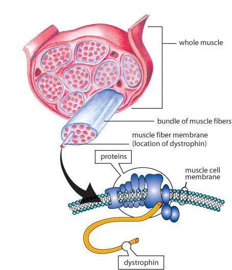 Duchenne Muscular Dystrophy - Dystrphin Gene Mendelian Inheritance, Lumbar Lordosis, Gastrocnemius Muscle, Knowledge Books, Duchenne Muscular Dystrophy, Therapy For Kids, Human Cells, Muscle Atrophy, Spinal Nerve