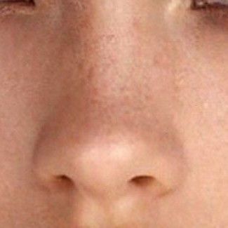 Round Nose Aesthetic, Small Nose Front View, Nose Inspo Front View, Upturned Button Nose, Nose Claim, Button Nose Front View, Small Button Nose, Perfect Nose Front View, Nose Job Inspiration