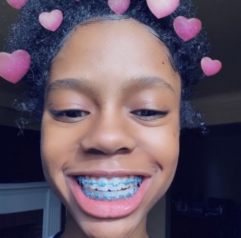 youknow I always come through withh some lit pinns ... follow me @lovejne01 for more ❤️ ... if you have any ideas on boards just message me ! & please give me my CREDIT all I ask LOVEYOUU Braces Types, Power Chains, Light Blue Braces, Brace Colors, Dental Braces Colors, Invisible Teeth Braces, Braces Colors Combinations, Girl With Braces, Braces Colours