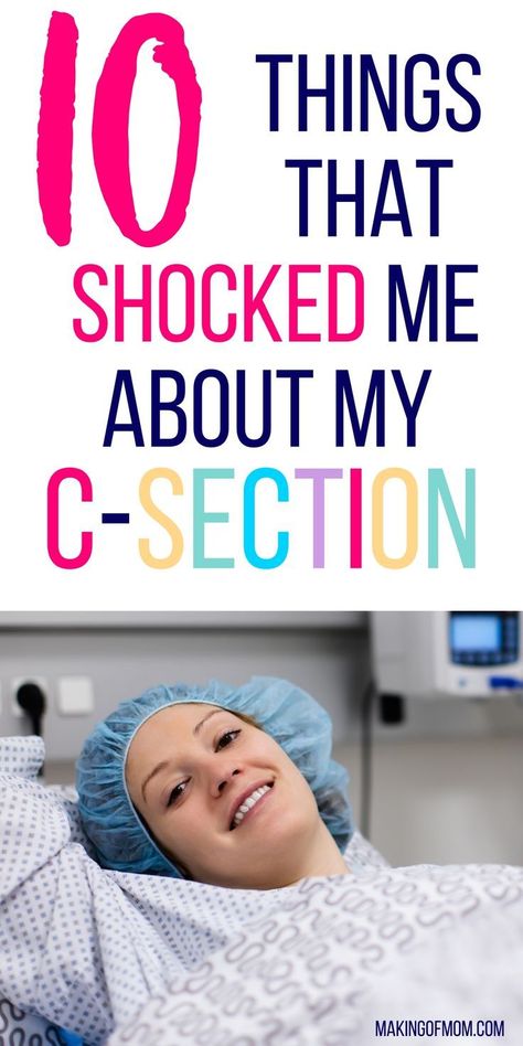 Planning for a c-section? Or want to know what to expect in an emergency? It can be quite shocking if you're not prepared - here are some c-section procedure and recovery things that surprised me. Prepare For C Section, Scheduled C Section, C Section Scars, Emergency C Section, C Section Recovery, Expecting Twins, Pregnancy Nutrition, Birth Labor, Mom Junction