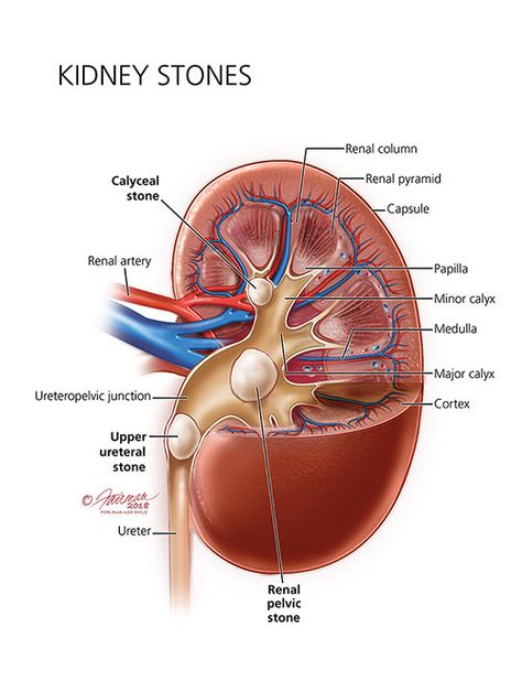 Kidney Stone, Basic Anatomy And Physiology, Human Body Anatomy, Biology Lessons, Medical School Essentials, Human Anatomy And Physiology, Medical Anatomy, Kidney Health, Body Anatomy