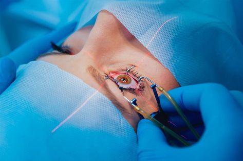 FDA warns that LASIK surgery patients need to be better informed of risks Corneal Transplant, Lasik Eye Surgery, Laser Vision, Eye Surgeon, Laser Eye Surgery, Lasik Surgery, Laser Eye, Laser Surgery, Vision Eye