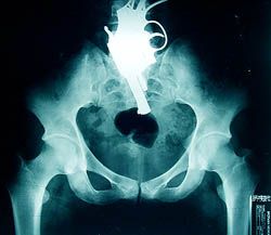 Funny and Weird X-rays - Gallery Weird Xrays, Funny Xray, Xray Humor, The Human Body, X Ray, Humor, Funny, Quick Saves, Art