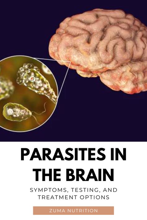 Not all parasites in nature affect humans, but many of them do. While parasitic infections are certainly more common in tropical countries or undeveloped countries with poor sanitation, people in the Western world are not immune. Therefore, it is important to practice good hygiene, take preventive measures, and periodically cleanse to keep your body parasite-free. Parasite Cleanse Smoothie, Deworming Humans Diy, Foods That Kill Parasites, Diy Parasite Cleanse, Parasites Cleanse, Brain Parasite, Parasites In Humans, Parasite Cleanse Diet, Herbal Parasite Cleanse