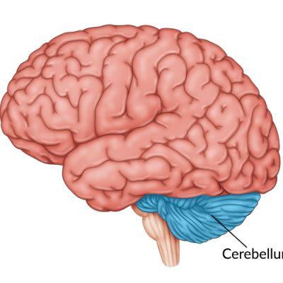 Foods That Help Stroke Recovery: 15 Evidence-Backed Options Types Of Strokes, Cerebral Cortex, Vision Therapy, Cognitive Therapy, Physical Therapy Exercises, Brain Stem, Memory Problems, Improve Cognitive Function, Vision Problems