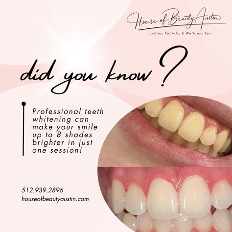 Ready to light up the room? Book your teeth whitening appointment now. 😁 Tumeric Teeth Whitener, Teeth Whitening Business Posts, Lumineux Teeth Whitening, Teeth Whitening Led, Laser Teeth Whitening, Room Book, House Of Beauty, Wellness Spa, Teeth Whitening