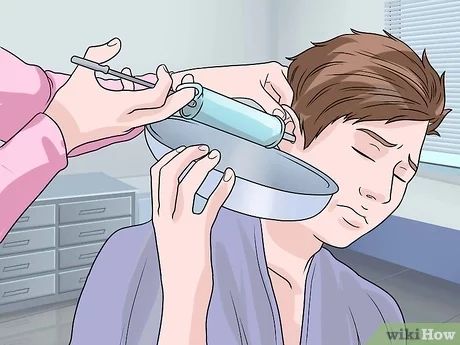 How to Remove Ear Wax Plugs (with Pictures) - wikiHow Remove Wax, Long Beanie, Ear Wax Removal, Ear Wax, Ear Plugs, Wax, Nutrition