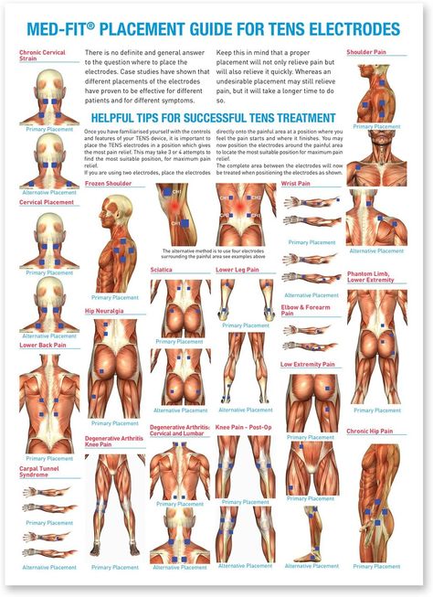 Tens Electrode Placement, Tens Unit Placement, Nerve Pain Remedies, Tens And Units, Sports Massage Therapy, Tens Machine, Tens Unit, Tens Ems, Ten Unit