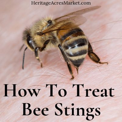 Bee Sting Swelling, Treating Bee Stings, Remedies For Bee Stings, Sting Relief, Wasp Stings, Beekeeping For Beginners, Very Sleepy, Backyard Beekeeping, Carpenter Bee