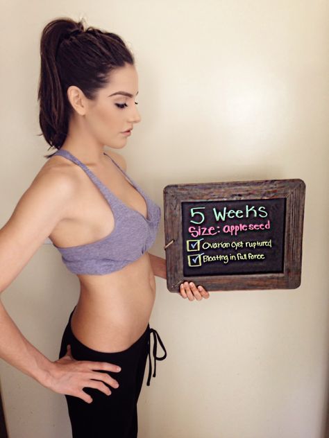 Zack&Sydney: Ruptured Cyst at 5 Weeks & 6-7 Week Pregnancy Update 5 Weeks Pregnant Belly, 5 Weeks Pregnant Ultrasound, Five Weeks Pregnant, 8 Weeks Pregnant, 7 Weeks Pregnant, 9 Weeks Pregnant, 10 Weeks Pregnant, 6 Weeks Pregnant, 5 Weeks Pregnant