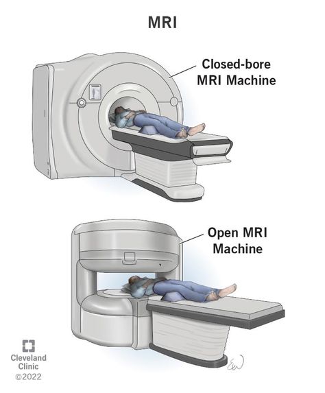 MRI (Magnetic Resonance Imaging): What It Is, Types & Results Mri Machine Image, X Ray Machine, Vagus Nerve Stimulator, Xray Machine, Mri Machine, Mri Technologist, Mri Tech, Radiology Technologist, Radio Waves