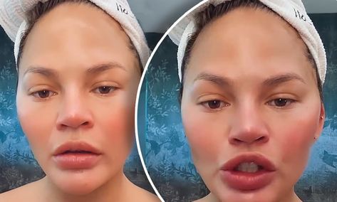 Chrissy Teigen wants to know what happened to the 'pretty filter' Pretty Filter, Chrissy Teigen, On Wednesday, The Model, What Happened, Beauty Tips, Beauty Hacks, Filter, Baby Face