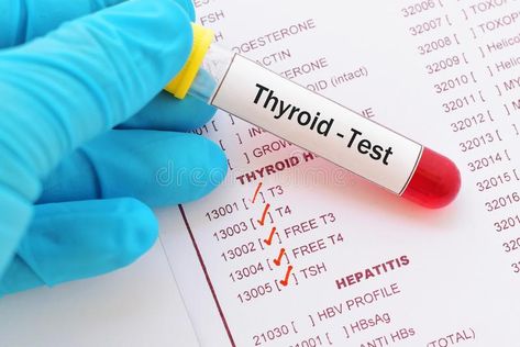 Thyroid hormone test stock image Stretches Exercises, Thyroid Levels, Foot Stretches, Thyroid Test, Pathology Lab, Thyroid Symptoms, Thyroid Medication, Graves Disease, Thyroid Issues