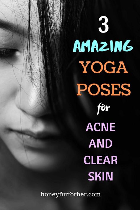 Clear Skin Exercise, Face Yoga For Pimples, Exercise For Clear Skin, Yoga Poses For Clear Skin, Exercise For Pimple Free Skin, Face Exercise For Acne, Yoga For Skin Problems, Yoga For Good Skin, Exercise For Acne Free Skin