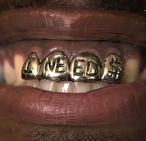 Gold Teeth, Close Up, Instagram Photos, Gold, On Instagram, Instagram