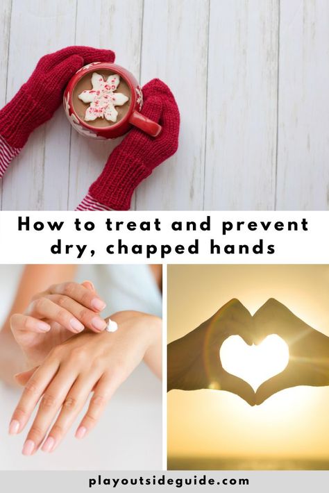 how to treat and prevent dry chapped hands Chapped Hands Remedy, Unscented Lotion, Chapped Hands, Play Outside, Dry Skin Care, Best Moisturizer, Dry Hands, Body Moisturizer, Moisturizer Cream