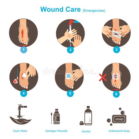 Wound Care. Your First Aid Care Guide Vector illustrations , #Sponsored, #Aid, #Care, #Wound, #illustrations, #Vector #ad Home Doctor, Antibacterial Soap, Wound Care, A Doctor, Vector Illustrations, First Aid, Clean Water, Stock Illustration, Medicine