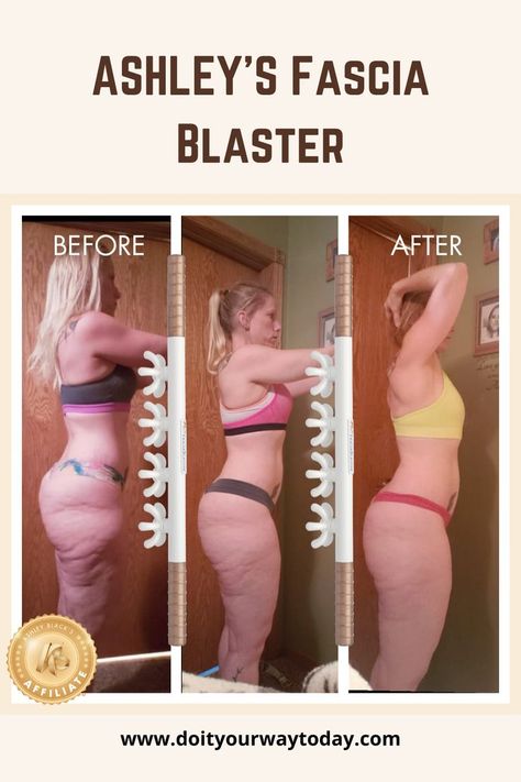 Do You Deal With Fascia Pain? Before They Were Offered To The General Public, The FasciaBlaster Gadgets Were Intended For Professional Athletes And Utilized By Celebrities For Years. Users Are Enhancing Their Lives Through Healthy Fascia Now That Over A Million FasciaBlaster Instruments Have Been Sold! #Fascia #Blaster #FasciaBlaster #FasciaBlastertools #SmoothsFascia Fascia Blasting, Fascia Blaster, Lower Body Fat, Lower Back Pain Exercises, Resistance Band Workout, Back Pain Exercises, How To Slim Down, Weights Workout, Benefits