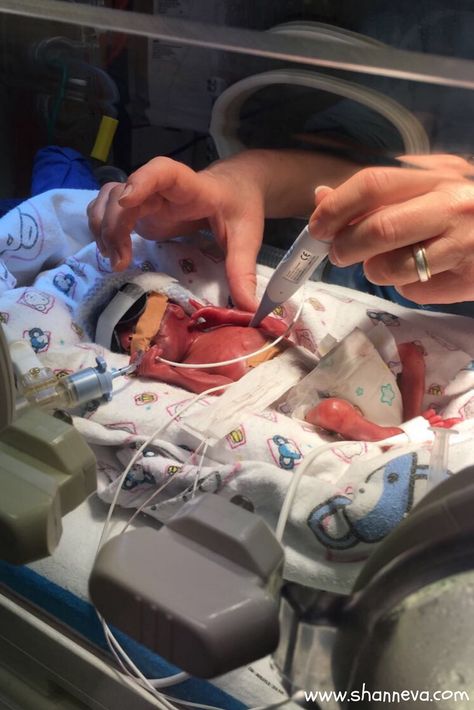 Support in the NICU: Luca's Story - Shann Eva's Blog Nursing School Inspiration, Midwifery Student, Nursing Motivation, Medical School Life, My Future Job, Nurse Inspiration, Nurse Aesthetic, Med School Motivation, Neonatal Nurse