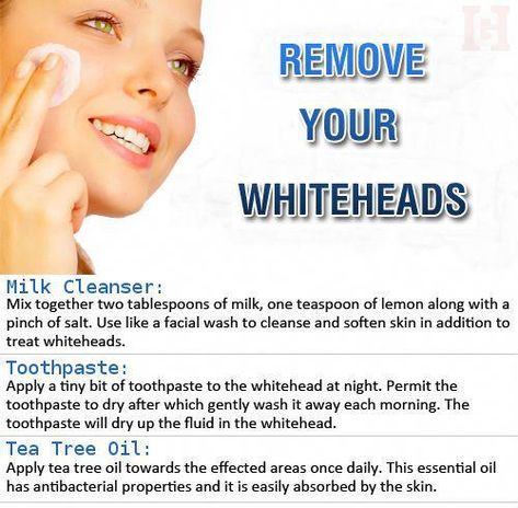 Chin Whiteheads, Chin Acne Remedies, Chin Breakouts, Chin Acne Causes, Whiteheads Remedy, Chin Acne, Weird Beauty, Blind Pimple, Rid Of Blackheads