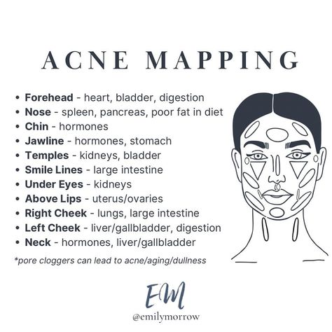 Acne face mapping is a technique that involves examining the location of acne on the face to determine potential underlying health issues.… | Instagram Acne Placement Meaning, Acne Face Mapping, Acne Face Map, Cheek Acne, Face Map, Hormone Nutrition, Causes Of Acne, Face Mapping Acne, Blood Work