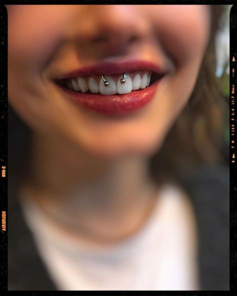 Smiley Piercing Smiley Piercing Aesthetic, Smiley Piercing Jewelry, Smile Piercing, Lips Piercing, Hippie Makeup, Cute Braces Colors, Cute Braces, Body Positivity Art, Braces Colors