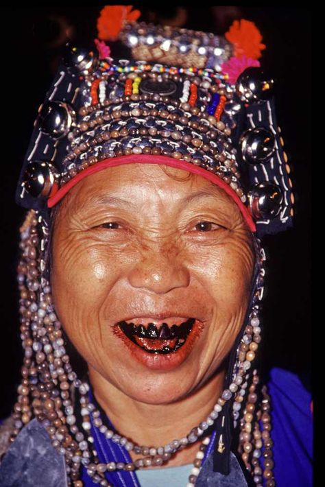 akha with black teeth-AsiaPhotoStock People With Crooked Teeth, Teeth Creepy, Black Teeth Japan, Open Faced Grill Teeth, Nice Smile Teeth Black Women, Black Teeth, Headdress, Festival Captain Hat, Body Art