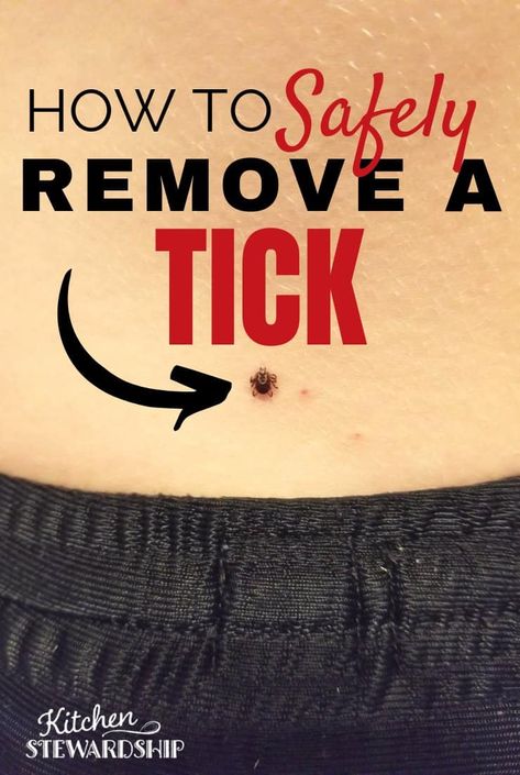 How to Identify and Safely Remove a Tick {WITH PICTURES}: #naturalremedies #naturalhealth Removing A Tick From A Person, How To Remove A Tick From A Human, Tall Grasses, Tick Removal, Healing Remedies, Essential Oils Herbs, How To Cook Beef, Glass Cooktop, Herbs For Health