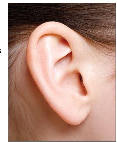 Middle Ear, Ear Wax Removal, Ear Wax, Hearing Loss, Hearing Aids, Your Head, 30 Years, Home Remedies, Surgery