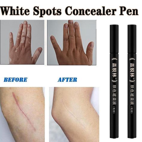 Buy Use White Spots Concealer Vitiligo Scars Cover Pen Camouflage Makeup Tattoo Concealer Liquid at affordable prices — free shipping, real reviews with photos — Joom Tattoo Concealer, Camouflage Makeup, Concealer Pen, Makeup Tattoo, Minimalist Makeup, Makeup Tattoos, Photo Makeup, Highlighter, Concealer